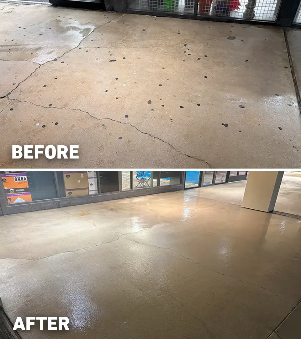 Before after gum removal